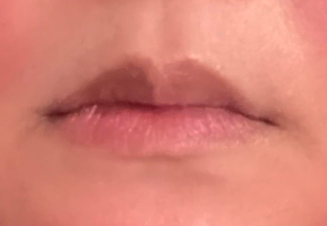 Customer before LipLift gloss