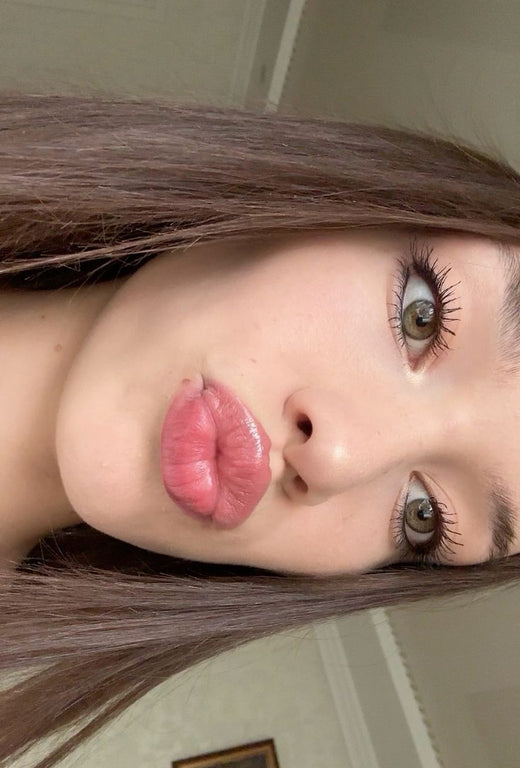 LipLift customer lip photo
