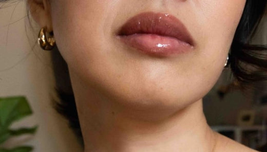 LipLift customer lip photo