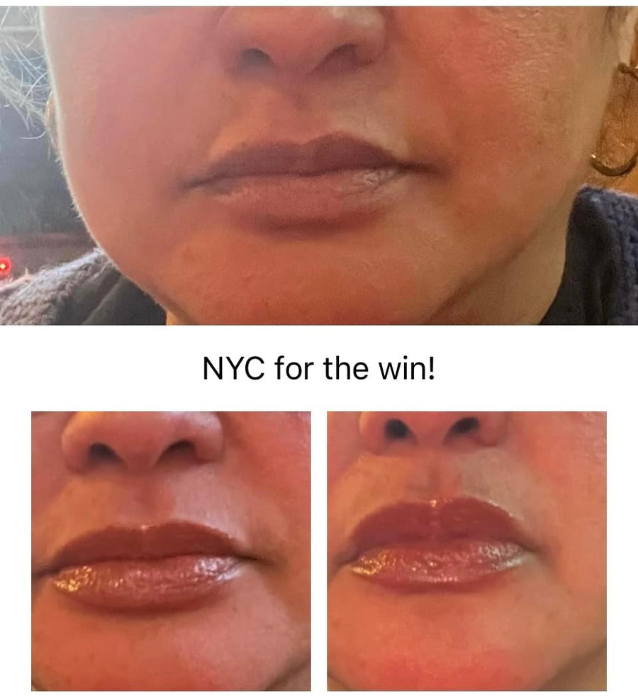 LipLift customer fuller-looking lips before and after result