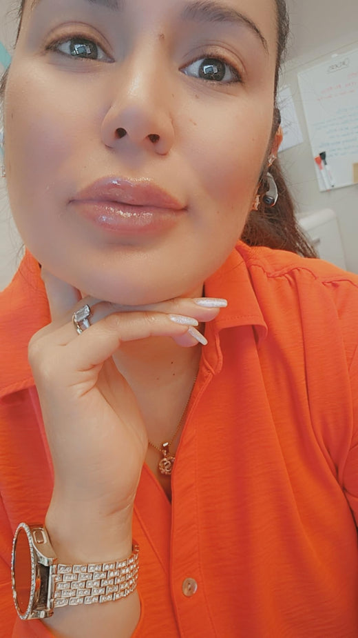 LipLift customer lip photo