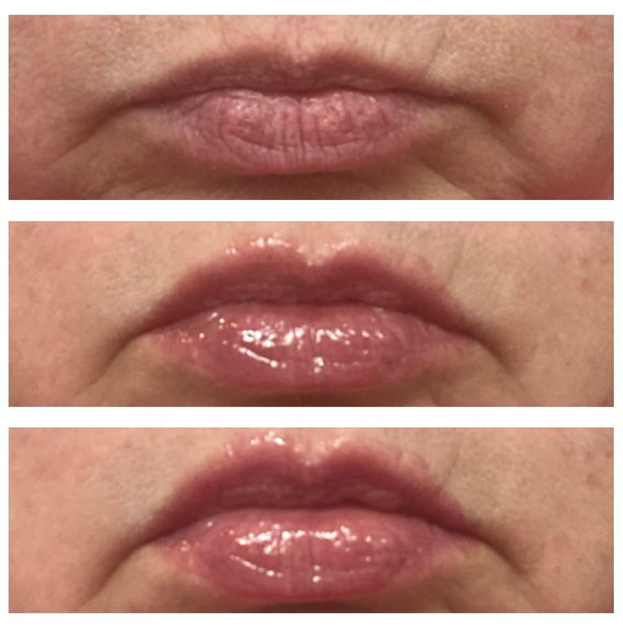 LipLift high shine lip plumper result
