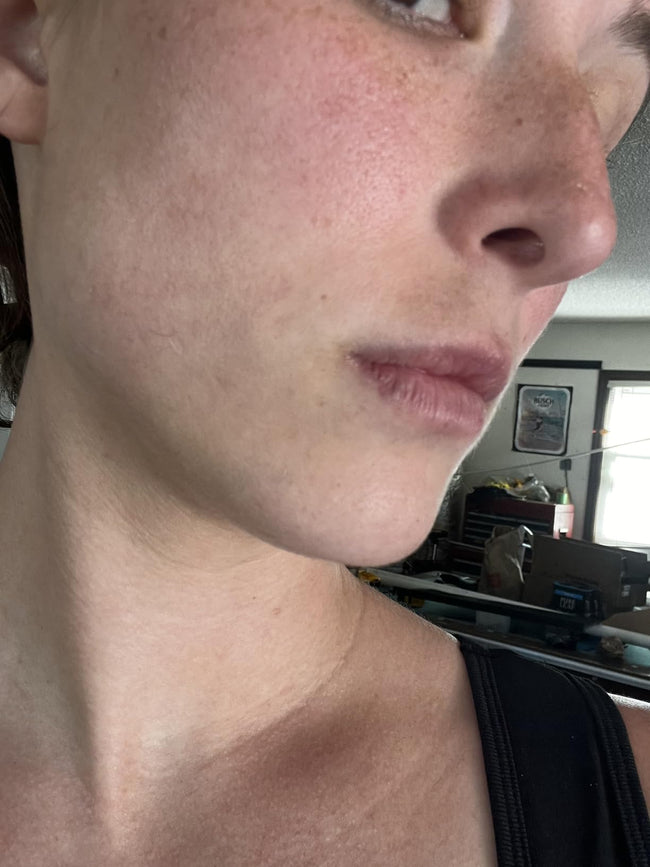 Customer before LipLift gloss