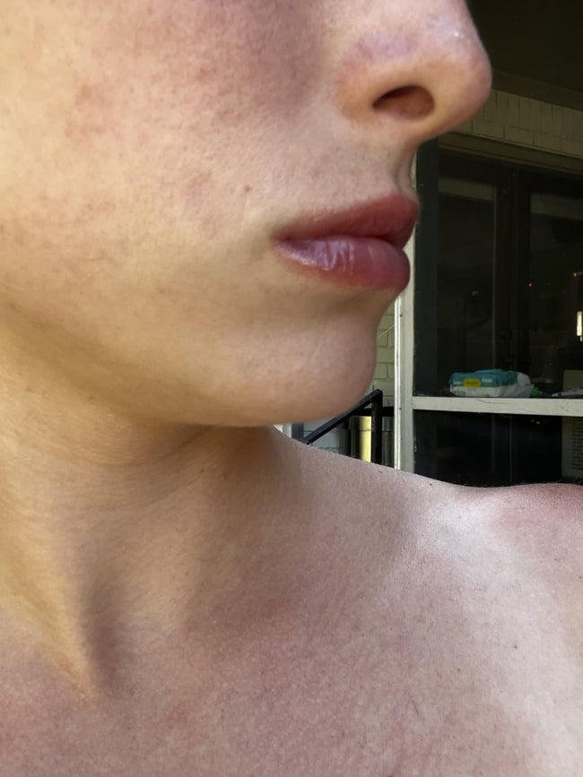 Customer after LipLift gloss