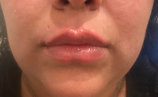 Customer after LipLift gloss