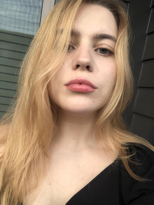 LipLift customer lip photo