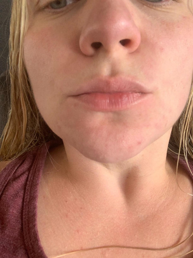 Customer before LipLift gloss