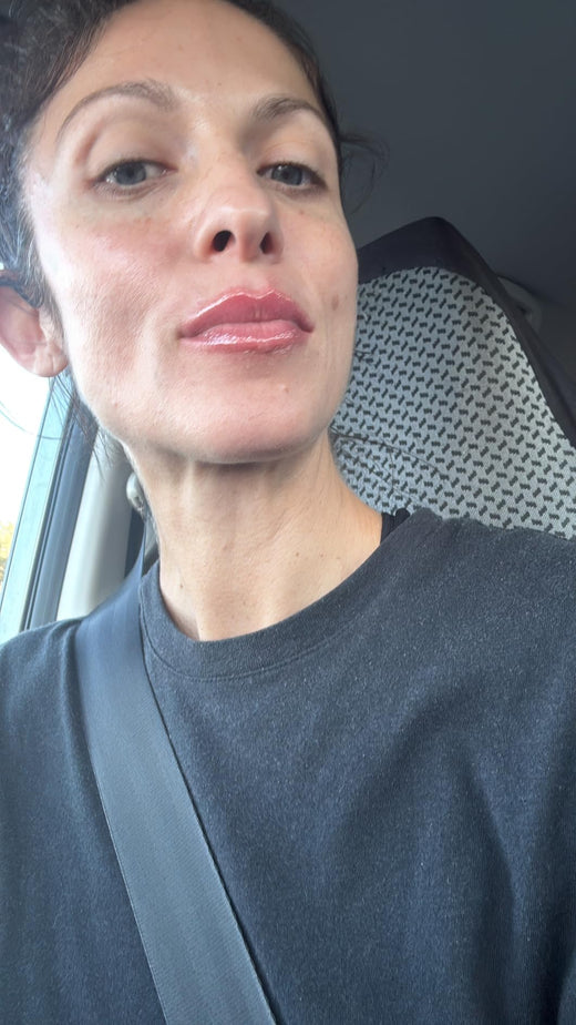 LipLift customer lip photo