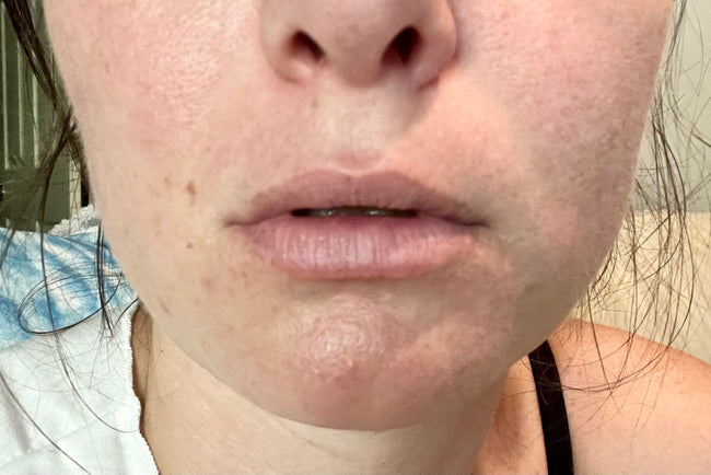 Customer before LipLift gloss