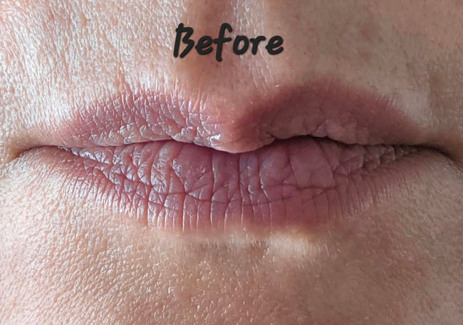 Customer before LipLift gloss