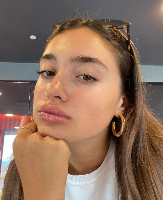 LipLift customer lip photo