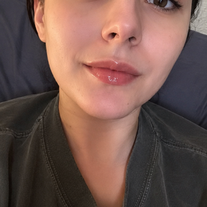 PeptiLift LipLift