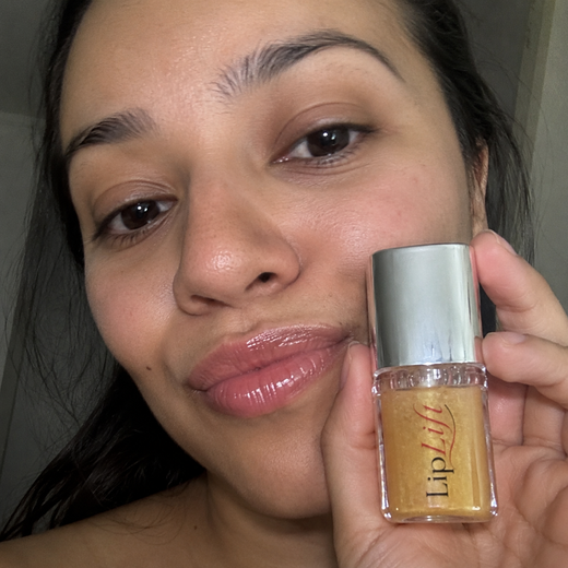 LipLift customer lip photo