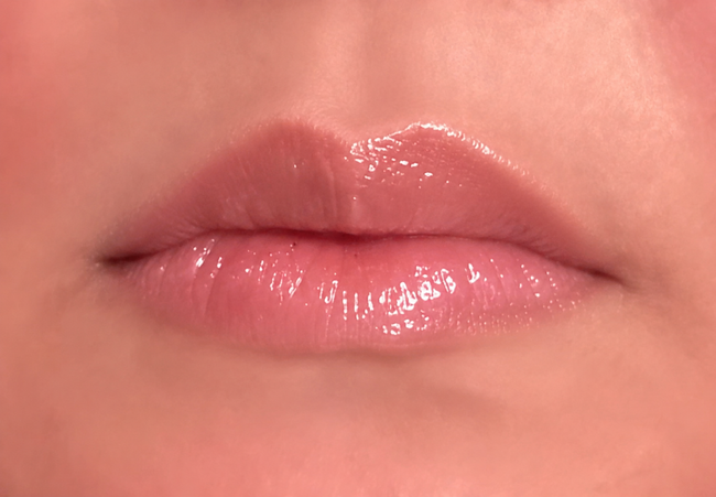 Customer showing LipLift glossy lip result