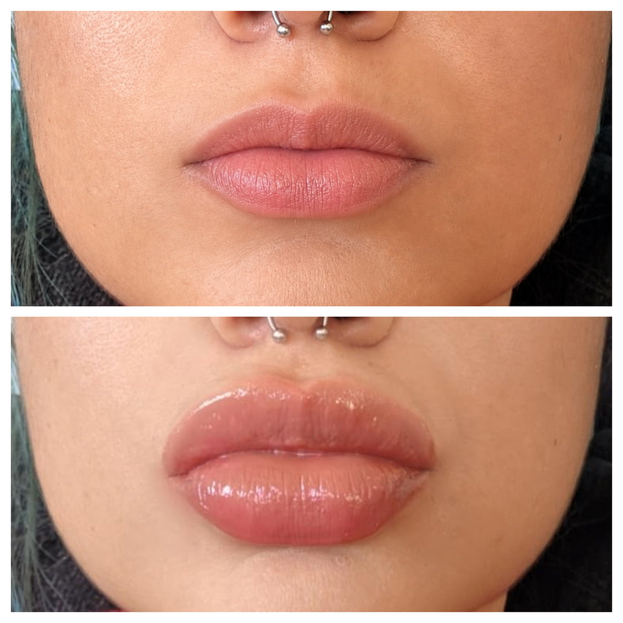 LipLift customer lip plumper result
