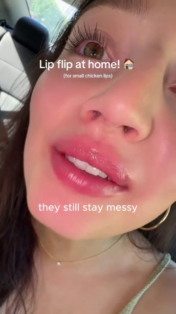 LipLift customer lip photo