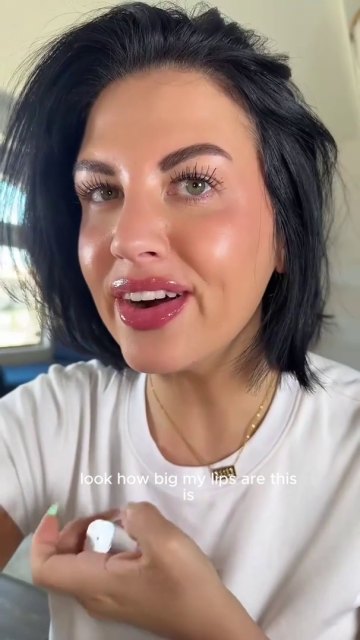 LipLift customer lip photo